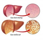 10 nguy cơ và dấu hiệu bệnh gan