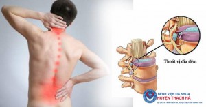Bệnh thoát vị đĩa đệm gia tăng, nguy cơ trẻ hóa