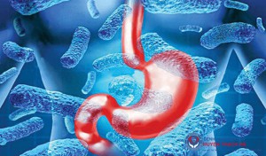 Bệnh dạ dày với helicobacter pylori dương tính