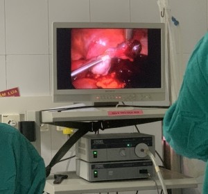 Mổ cấp cứu kịp thời bệnh nhân chữa ngoài tử cung vỡ