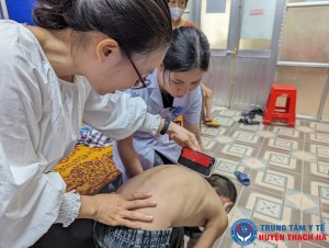 Khám và tư vấn miễn phí bệnh lý gù vẹo cột sống