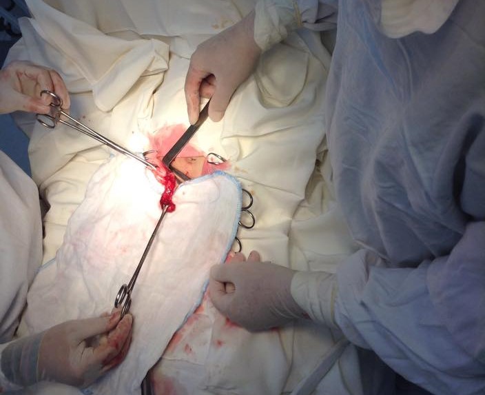 Các bác sỹ đang tiến hành mổ cho bệnh nhi 34 tháng tuổi.