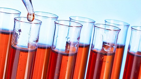 Xét nghiệm máu giúp dự đoán nguy cơ bị tim trong vòng 5 năm tới