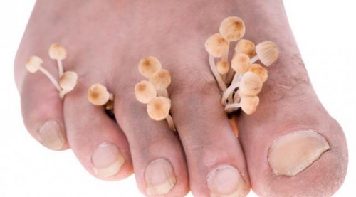 Hình minh hoạ từ Internet.