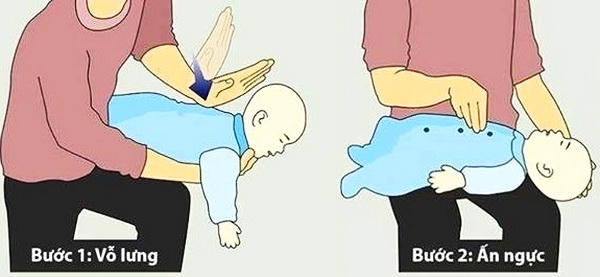 Hướng dẫn sơ cứu xử lý đúng cách khi trẻ bị hóc dị vật đường thở các bậc cha mẹ cần phải biết