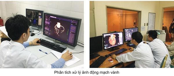 GS.TS Phạm Minh Thông: Đưa Điện quang can thiệp thần kinh lên tầm cao mới