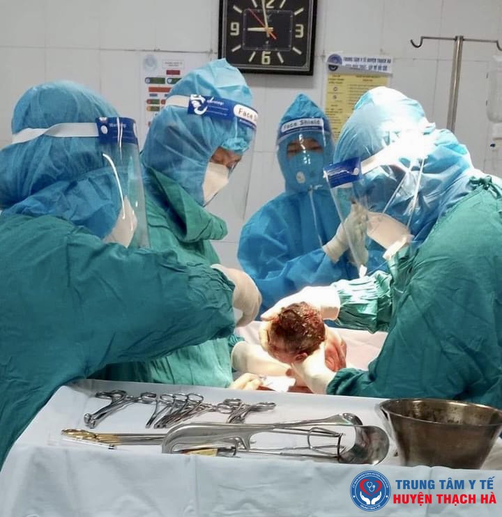 TTYT huyện Thạch Hà: Mổ lấy thai thành công cho sản phụ mắc COVID-19 có dấu hiệu suy thai