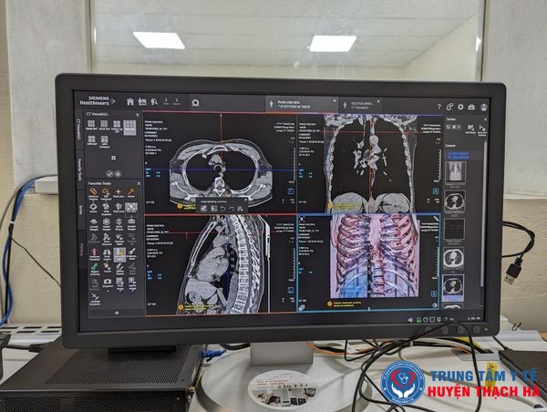 441938960 944763647620634 9159769087659536437 n